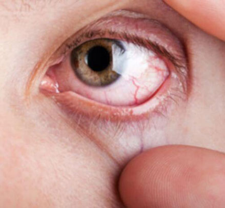 Mulamoottil Eye Hospital, Eye Care, Lasik, Cataract, Laser, Kozhencherry, Pathanamthitta, Kerala, India