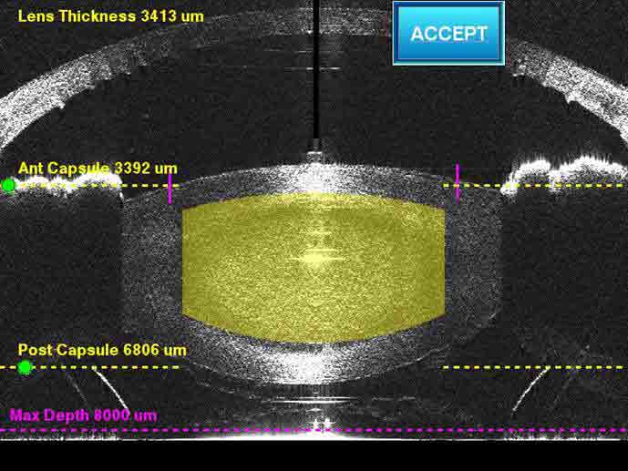 best eye hospital in Kerala