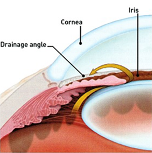 Eye specialists in Kerala
